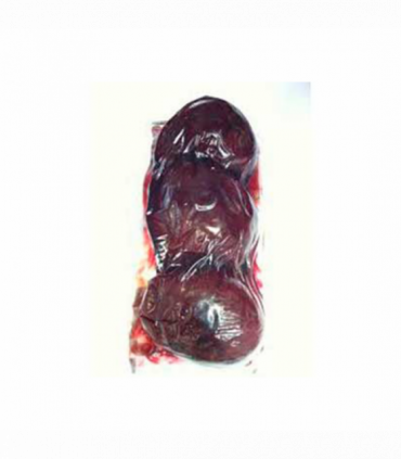 REVUELTO CHAMPIÑON-SETAS-AJETES-ESPÁRRAGOS